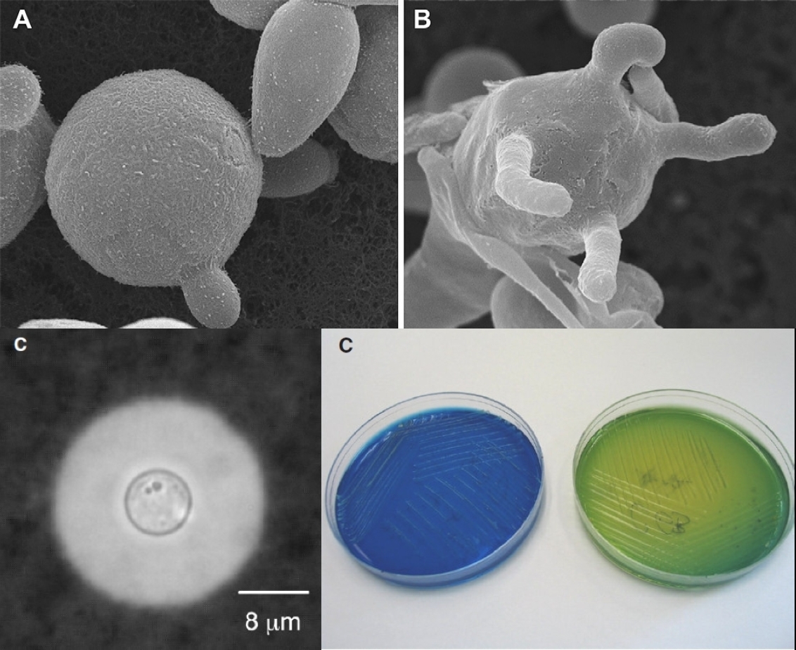 C. Cryptococcus gattii i Candida auris - dwa grzyby w barszcz