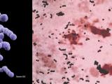 Paciorkowce grupy B - Streptococcus agalactiae